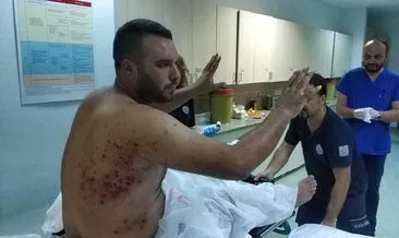 Kına gecesinde tüfekle vurulan 7 kişi hastanelik oldu!