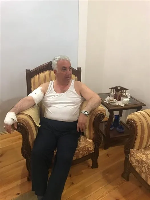 Arpaçay Belediye Başkanı, köpek saldırısında yaralandı