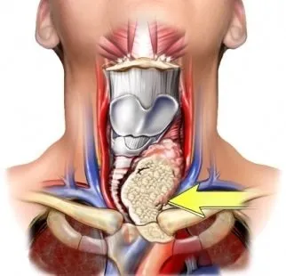 Tiroid ile ilgili doğru bilinen yanlışlar…