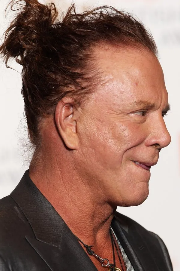 Ünlü aktör Mickey Rourke estetik operasyonların kurbanı oldu