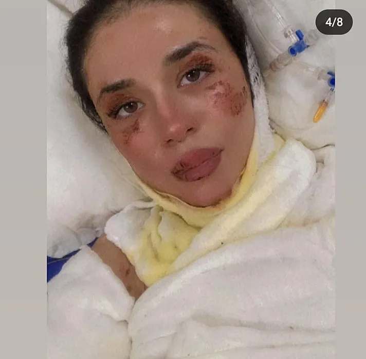 Gizem Hemşire hastanedeki dehşeti anlattı: Yakayım mı sizi dedi ve...