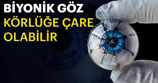Biyonik Goz Korluge Care Olabilir En Son Haber