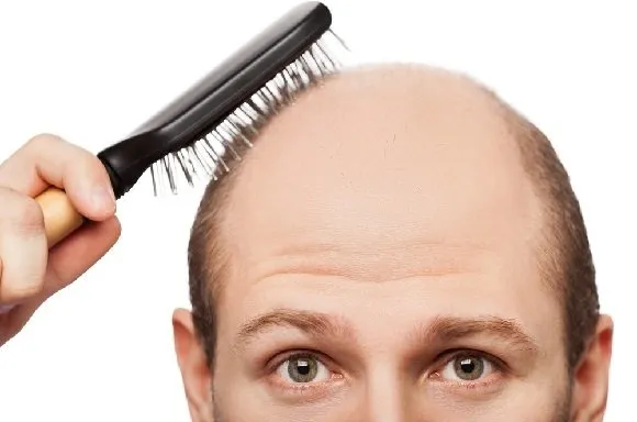 Saç dökülmesi neden olur, tedavisi nelerdir?
