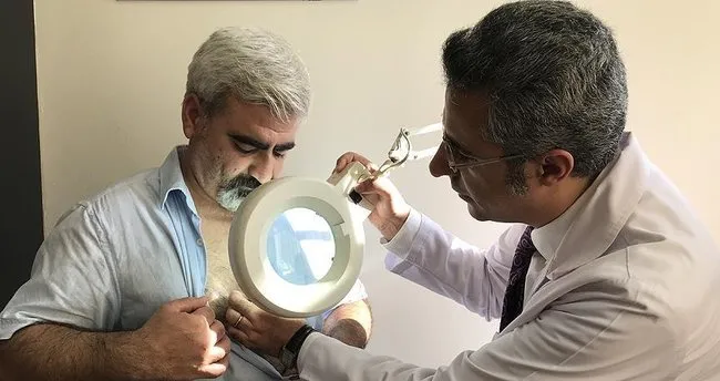 bir sivilceyle baslayan hastaligiyla 12 yildir mucadele ediyor son dakika haberler