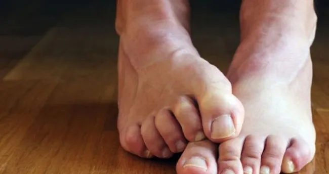 huzursuz bacak sendromu belirtileri