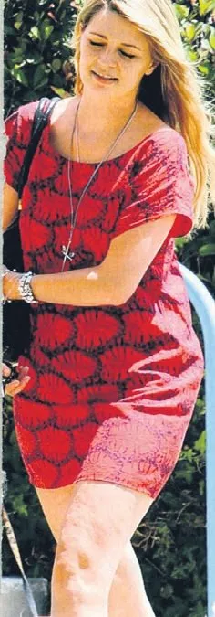 Selülitli güzeller
