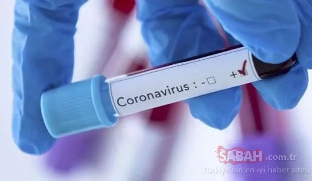 Dünya genelinde corona virüsünde son durum nedir? Canlı corona virüs haritası