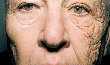 Bu adamın yüzünün yarısı 20 yaş daha genç! Nedenine inanamayacaksınız...