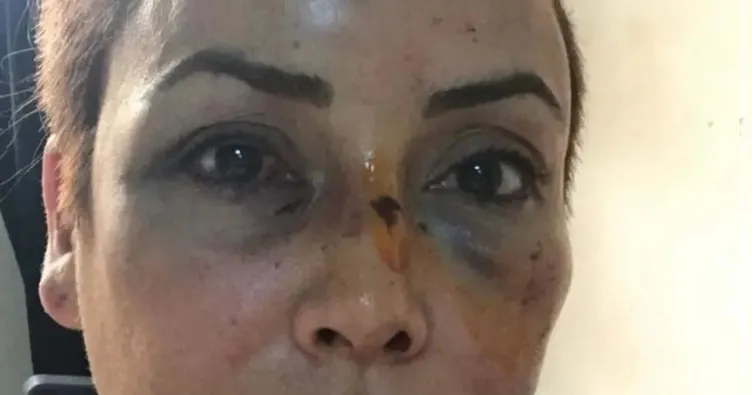 8 yılda annelik hakkım elimden alındı