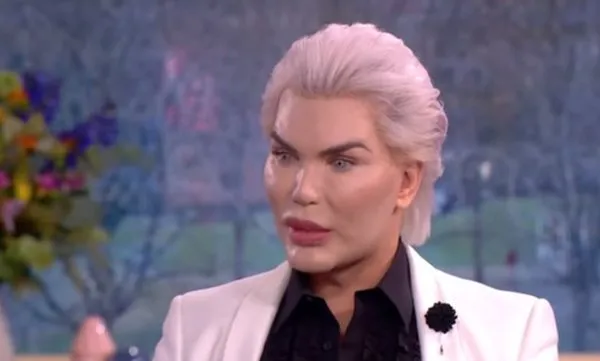 İşte Ken Bebek Rodrigo Alves'in estetiksiz hali