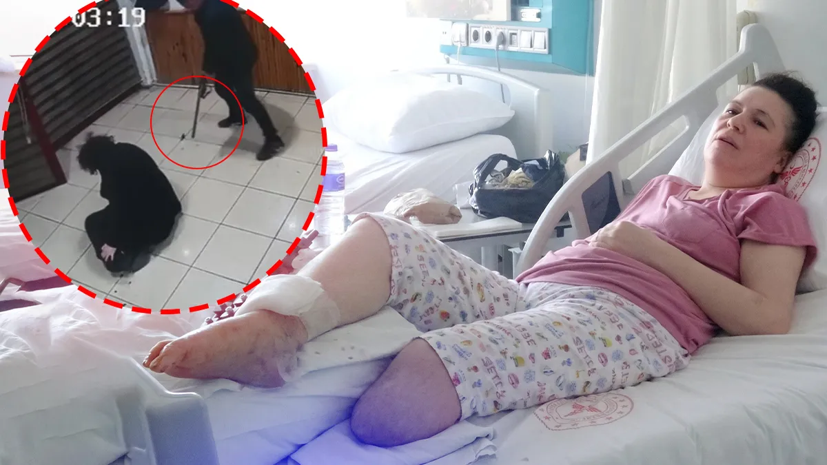 Boşanma aşamasındaki eşine kurşun yağdırdı! Bacağını kaybeden talihsiz kadın kabus dakikalarını anlattı: 'Ben onu vurmaya gidiyorum’ deyip…