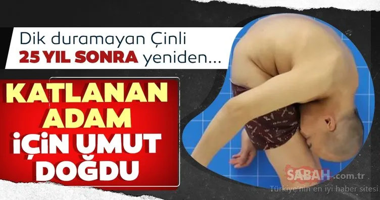 Çin'in katlanan adamı 25 yıl sonra yeniden yürüyebilecek mi?