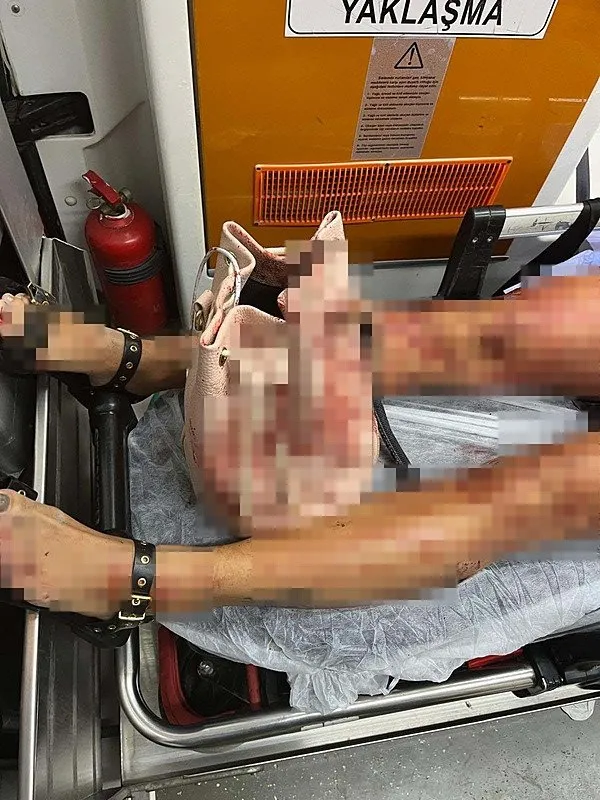 Ukrayna asıllı Türk vatandaşı Iryna’ya kocası öyle şeyler yaptı ki: Beni öldürmeye geldi!