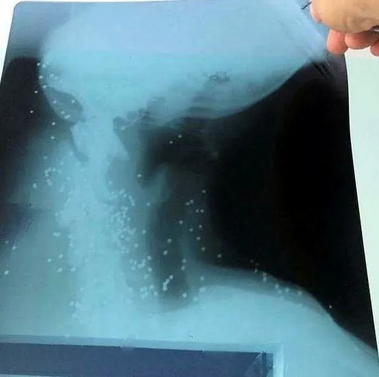 Yaralı köpeğin röntgen filmini görenler şoke oldu!