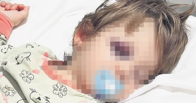 Baba ve 14 aylık kızına vahşi saldırı