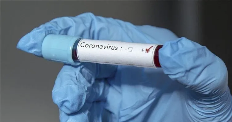 İsrail’de yeni tip koronavirüs vaka sayısı 1442’ye yükseldi