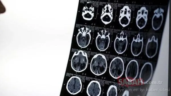 Polisler şoke oldu! Nefes almak için kafasına bıçak sapladı
