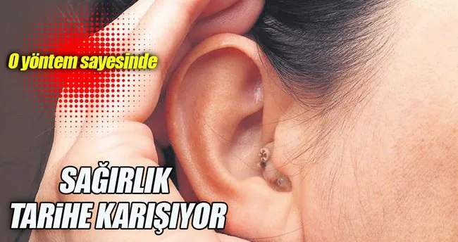 Sagirliga Karsi Kok Hucre Tedavisi En Son Haber