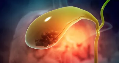 Prof. Dr. Canan Karatay’dan safra kesesi alınanlara hayati uyarı! Bu besini ağzınıza bile sürmeyin yoksa bağırsaklarınız...