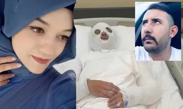 Eski nişanlısı Merve Küçüktekin'i kezzap dökerek yakmıştı: O caninin cezası belli oldu! #konya