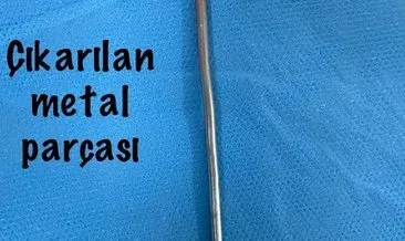 Kayseri’de idrar yolu hastalığı bulunan bir kişi, idrar yoluna metal parça soktu #kayseri