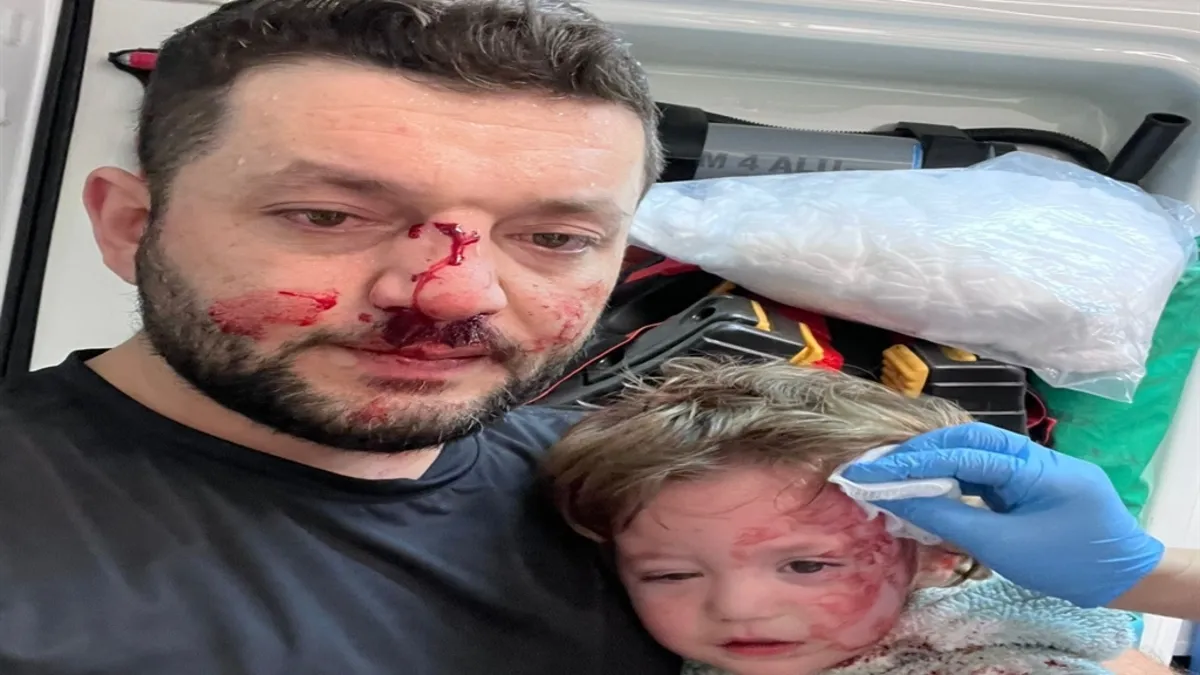 Baba ile 14 aylık İkra bebek darbedilmişti: Türkiye'nin konuştuğu olayda yeni detaylar! 'Kızım en ufak seste...'