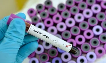 SON DAKİKA HABERİ: Corona virüs salgınına ilişkin ABD raporu geldi! Günde 2 bin 300 kişi ölecek, sonra…