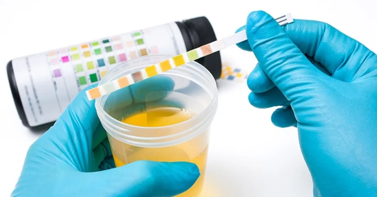 hamilelikte idrar rengi saglikli bir anne adayinin hamilelikte idrari ne renk olmali ve idrar rengi zaman degisir saglik haberleri