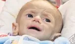 Çocuklar açlıktan gözlerini kaybediyor