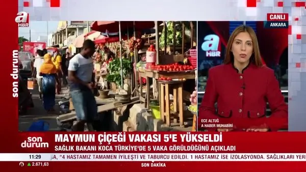 SON DAKİKA: Bakan Koca açıkladı! Türkiye'de 5 Maymun Çiçeği vakası görüldü | Video