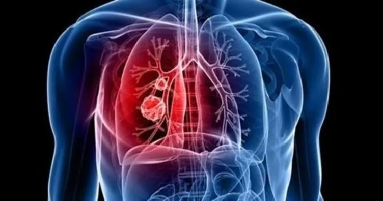 Gün gün korona corona pandemi virüs belirtileri neler? Koronavirus-belirtileri-gun-gun-nasil-ortaya-cikiyor-koronavirus-belirtileri-nelerdir-kac-gunde-belli-olur-1609440964215