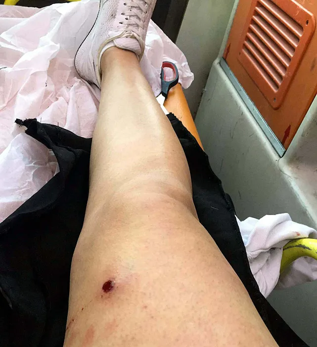 Aysel’i canice vuran koca için karar verildi: Acı çekmesi için ayaklarına ateş ettim…