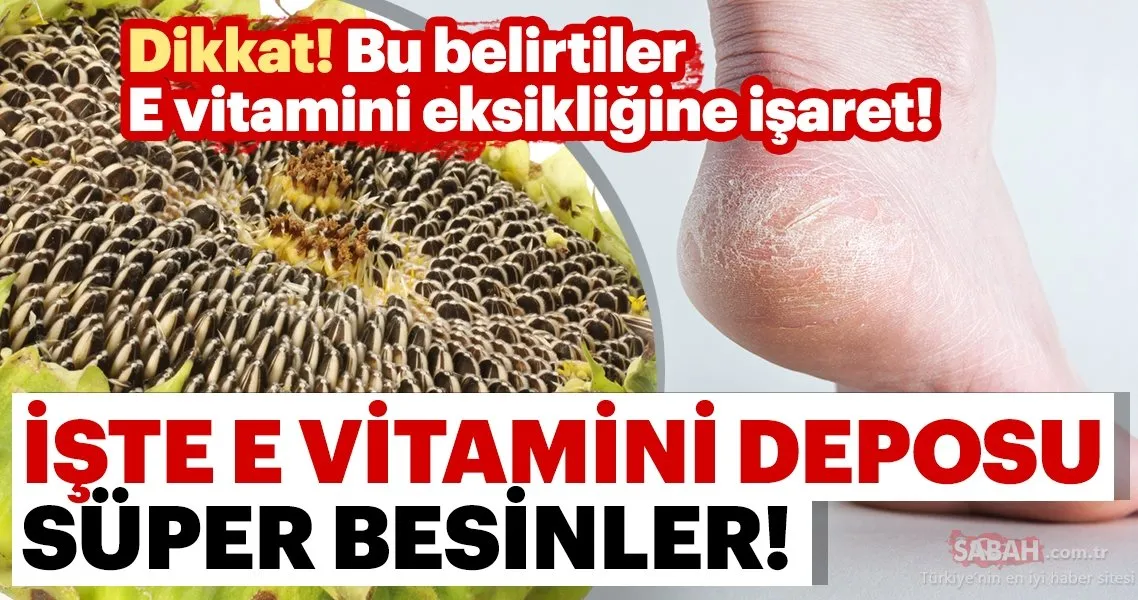 iste e vitamini deposu super