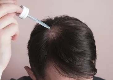 Saç dökülmesi sorununu kökten çözecek! Haftada üç gün saç diplerine uygulayın: Ne kellik kalacak ne açıklık