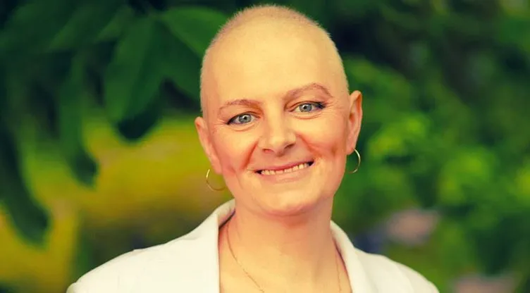 Kemoterapi tedavisinde dökülen saçlara hiç üzülmeyin!