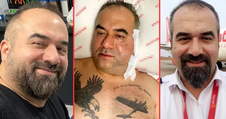 Pilot Buğra Arif Uçku ihmal kurbanı oldu: Uçuşa gidiyorum diyerek girdiği ameliyatta öldü!