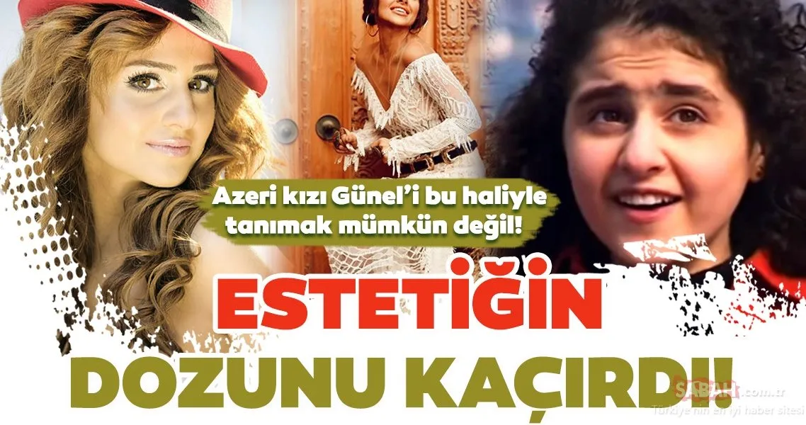 Azeri kızı Günel estetiğin dozunu fazla kaçırdı! Günel Zeynalova’yı