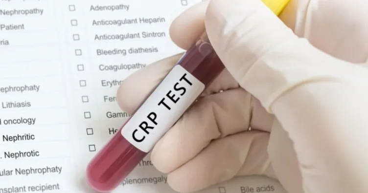 CRP nedir? CRP hangi durumlarda yükselir?