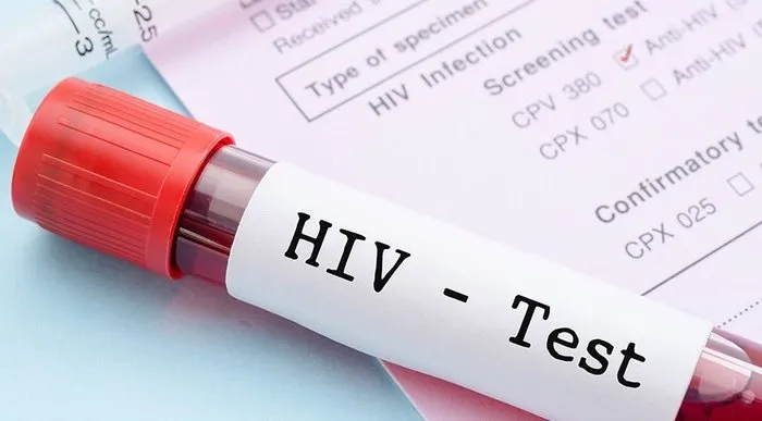 aids belirtileri nelerdir aids nedir