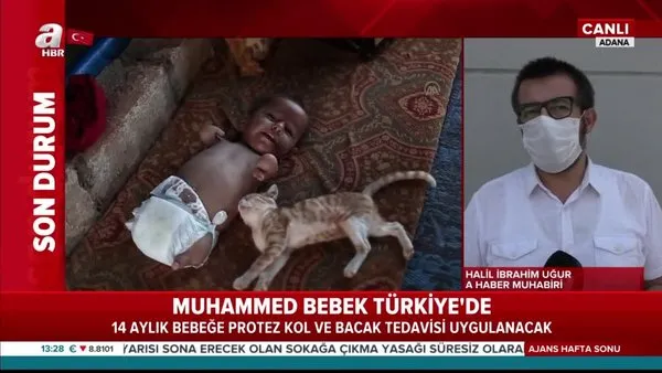 Kolları ve ayakları olmayan İdlibli Muhammed Bebek Hatay'da tedavi altına alındı | Video
