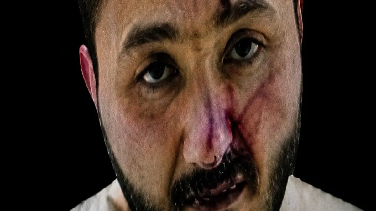 Polislerimizi şehit eden saldırganla ilgili şok detay… Şizofreni hastası Polislerimizi şehit eden saldırganla ilgili şok detay… Şizofreni hastası