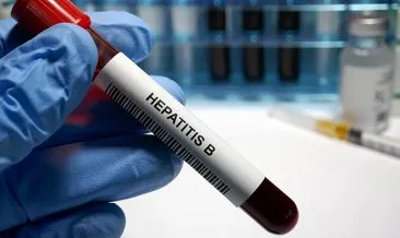Hepatit B nedir, nasıl bulaşır? İşte Hepatit B belirtileri