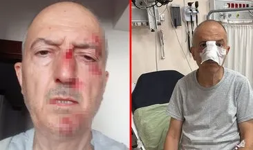 Boşanma aşamasındaki adamın başına gelmeyen kalmadı: Önce evinden atıldı sonra burnu kırıldı! #afyonkarahisar