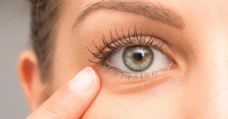 gozde it dirsegi arpacik neden cikar it dirsegine ne iyi gelir nasil gecer saglik haberleri