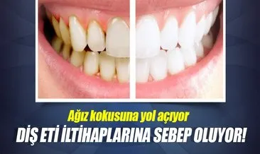 Dis Eti Iltihaplarina Sebep Oluyor Son Dakika Haberler