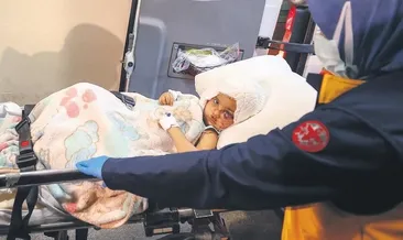 Anne yüzüm iyileşecek mi?