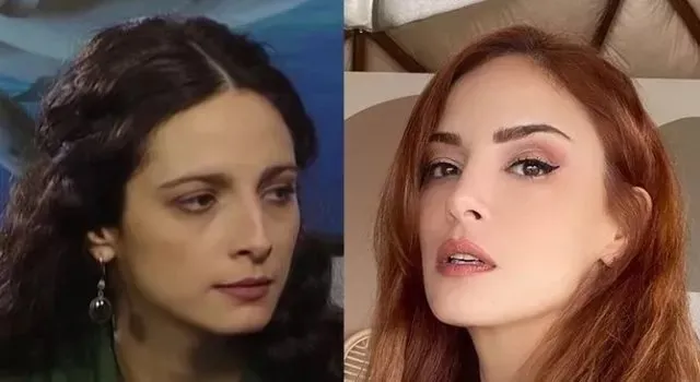 Мине тугай пластика до и после: найдено 89 изображений