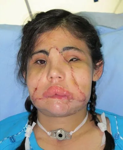 Hatice Nergis yeni yüzünü ilk kez gördü