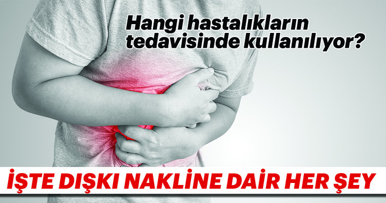diski nakli gaita nakli nedir hangi
