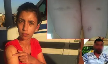 Adana’da genç kadına yapılan işkence kan dondurdu: Şarj kablosuyla bağlamış!